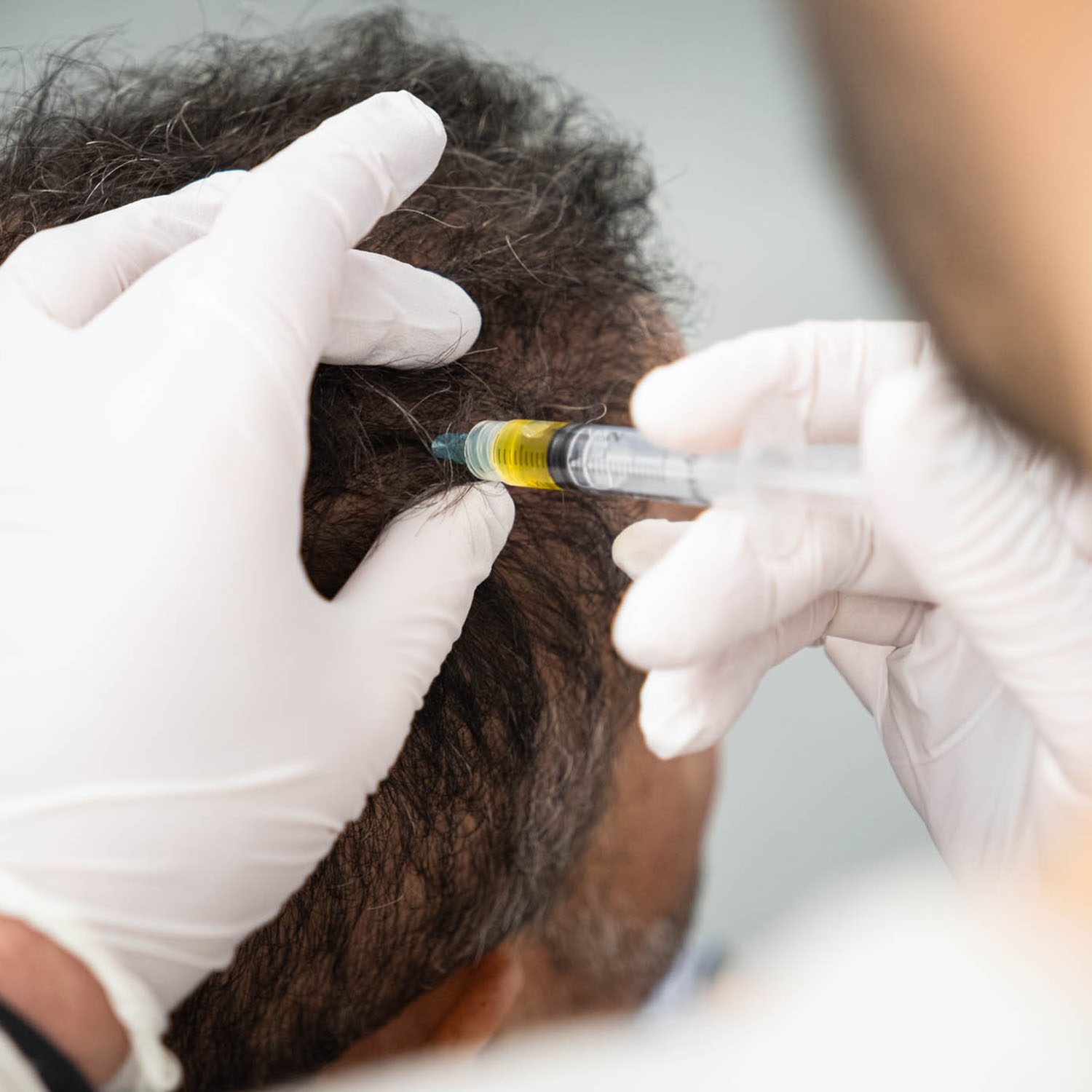 Hair Restoration Schulung 06.–07.11.2027 in Stuttgart (Kernen)