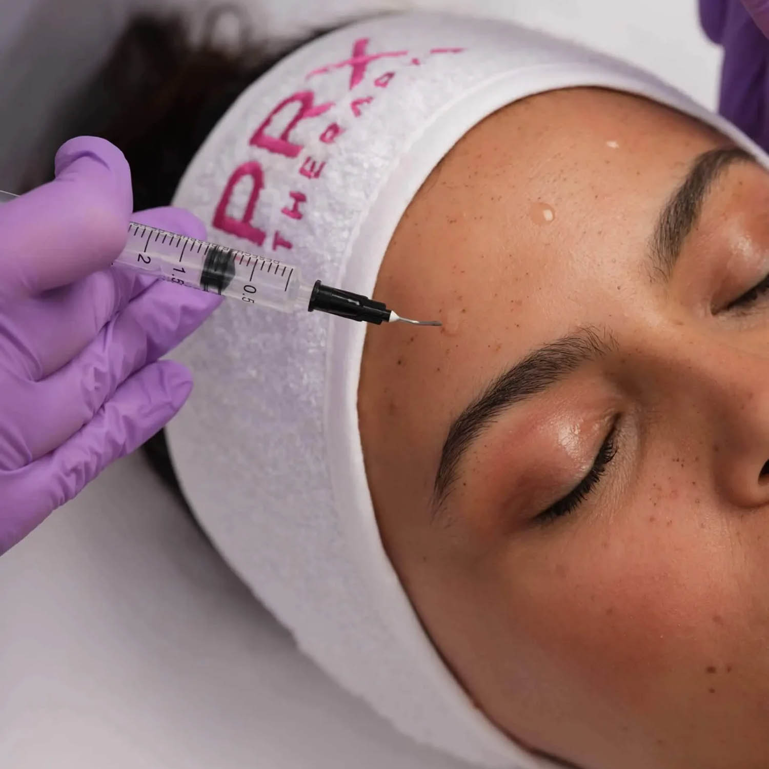 PRX-T33® Peeling PRX-T33® Peeling