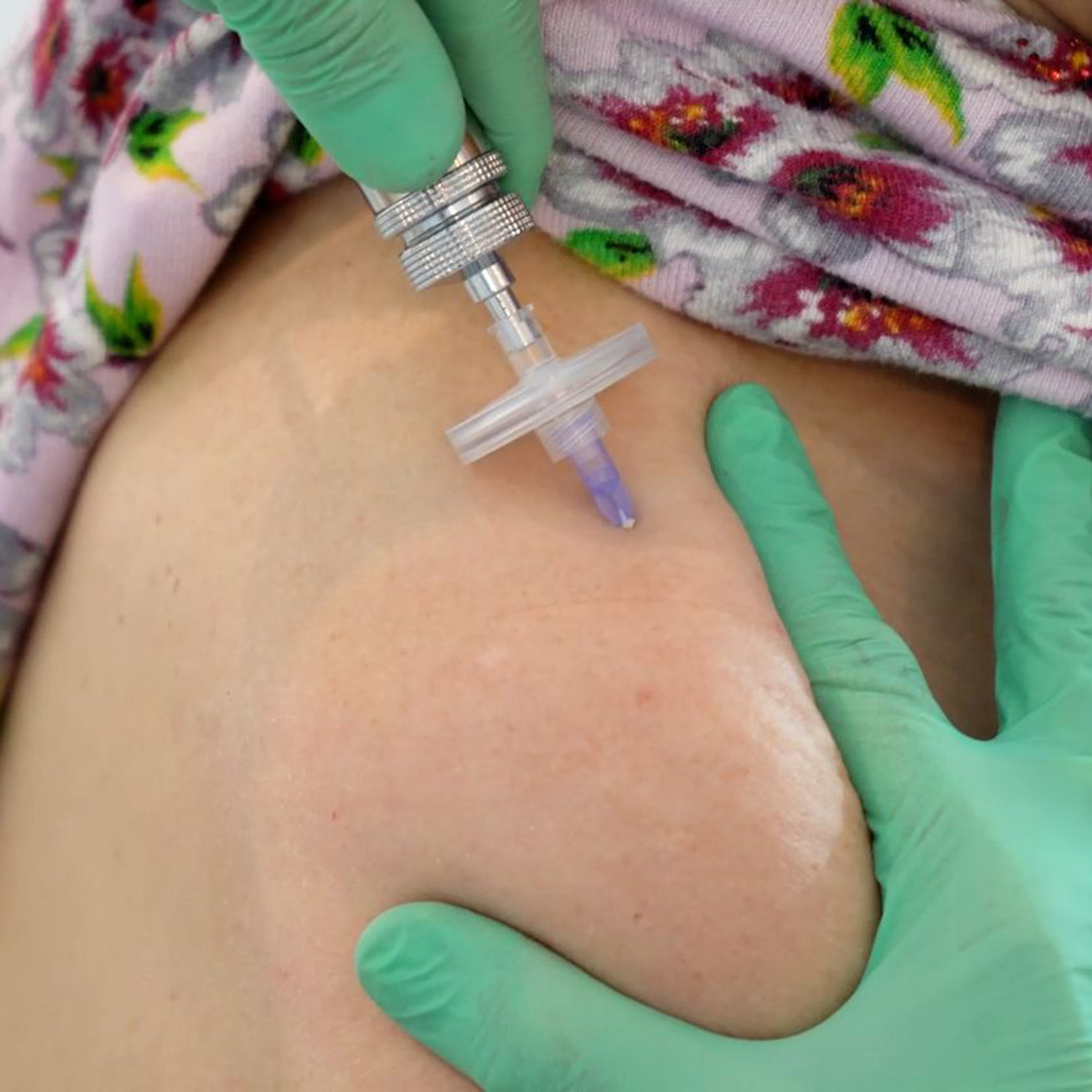 Hygienefilter