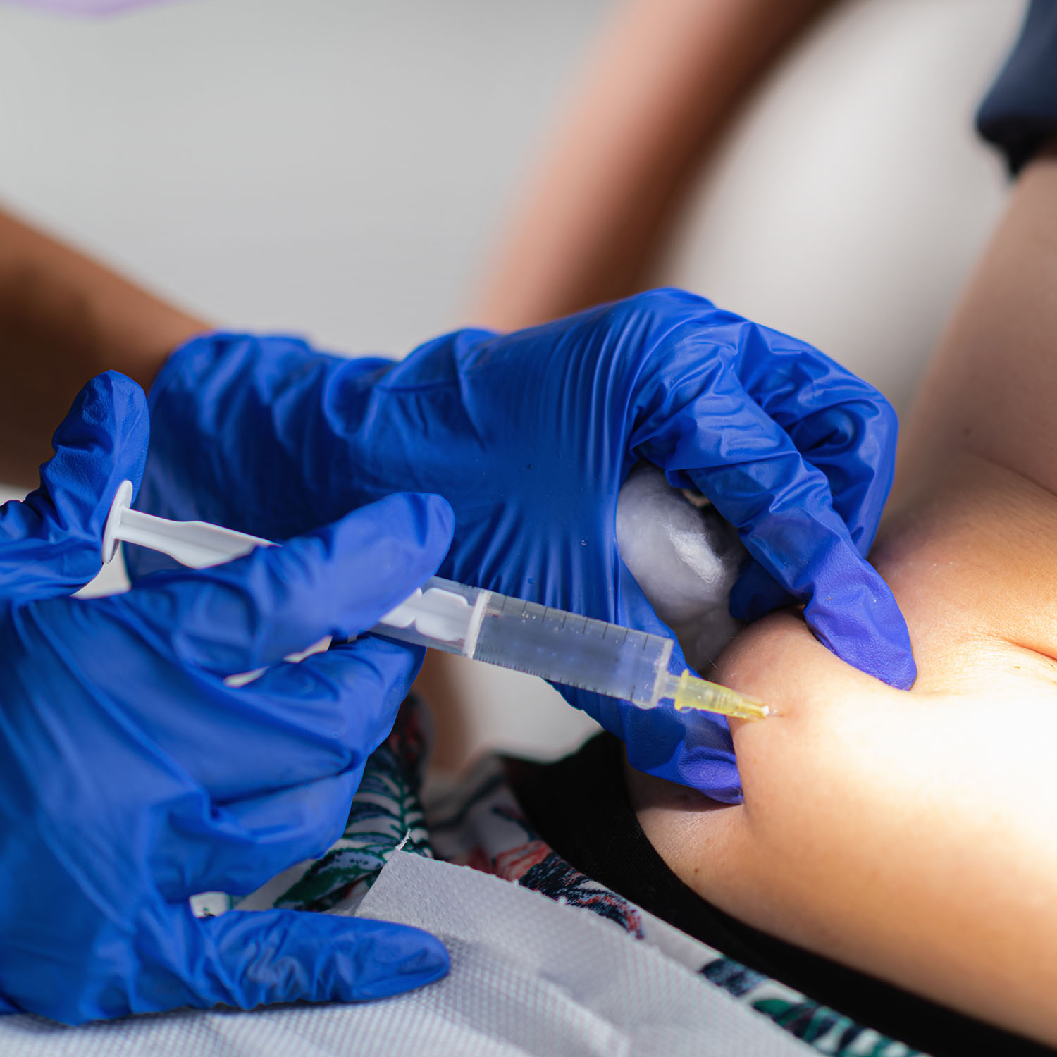Liposuktion+ Schulung am 06.10.2025 in Wien