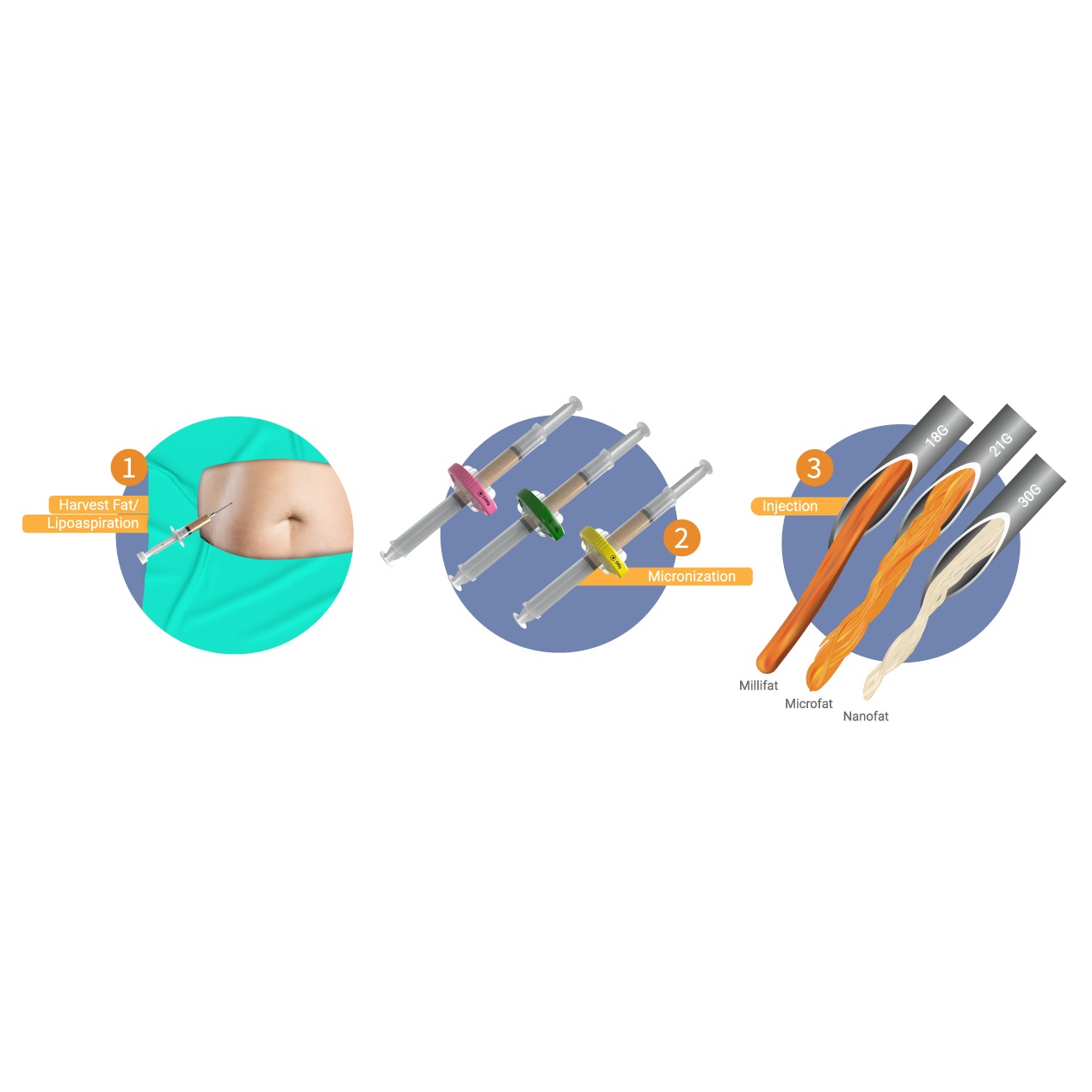 Lipomine Kit